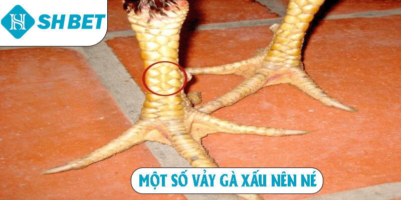 Một số vảy gà xấu nên né